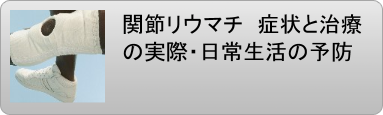 関節リウマチ