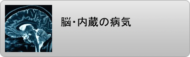 脳梗塞 脳卒中 内臓の病気