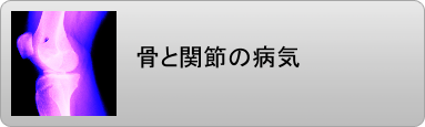 骨粗鬆症 関節の病気